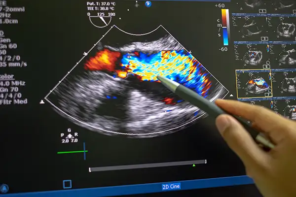 FORTE CARDIOLOGY transthoracic