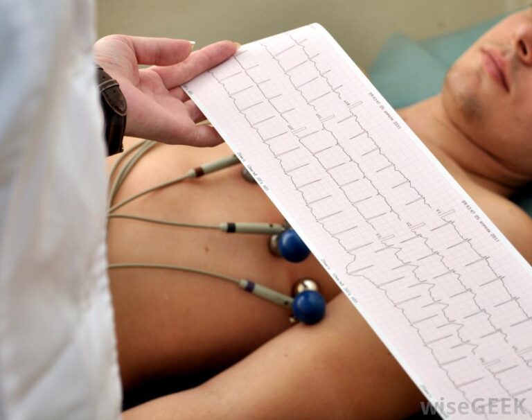 Electrocardiography (ECG) - Forte Cardiology Clinic Electrocardiography (ECG)