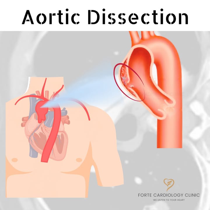 Forte Cardiology Clinic