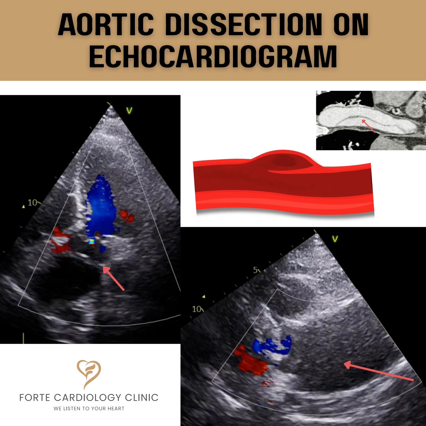 Forte Cardiology Clinic